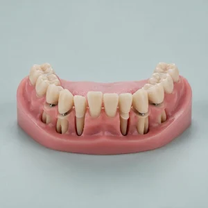 Lower Preparate Teeth