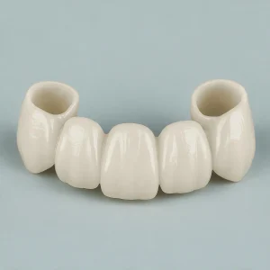 Zirconia Bridge With Ceramics