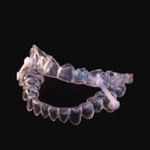 3D Printed Splint