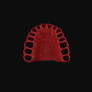 Upper Gingiva