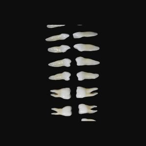 Upper Teeth